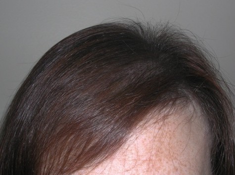 Olio di capelli con minerali del Mar Morto