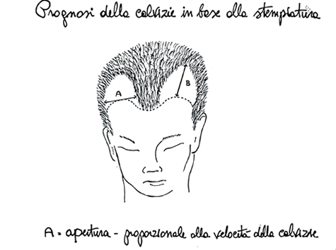 Se i capelli con un bulbo devono abbandonare