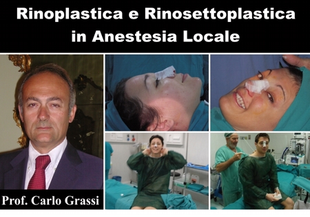 Rinoplastica e Rinosettoplastica in Anestesia Locale