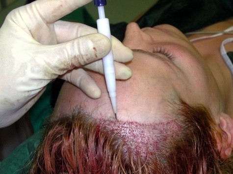 Maschera dai capelli spaccanti con una fotografia