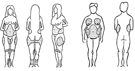 Modellamento Estetico del Corpo